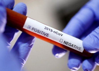 Dobra número de pessoas diagnosticadas com Covid-19 em agosto