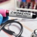 Diretor europeu da OMS alerta que Mpox não é uma ‘nova Covid-19’
