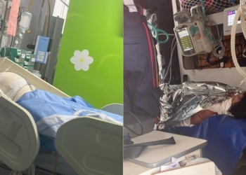 Adolescente tem corpo queimado enquanto dormia em Salvador