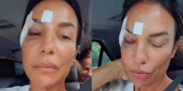 Ivete Sangalo recebe alta de hospital em Salvador após acidente e fala sobre diagnóstico